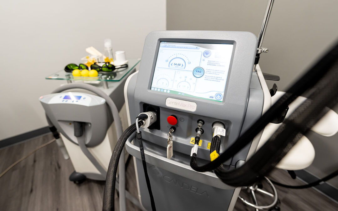 8-cynosure-laser-treatment-machine-saugus-clinic-1080x675