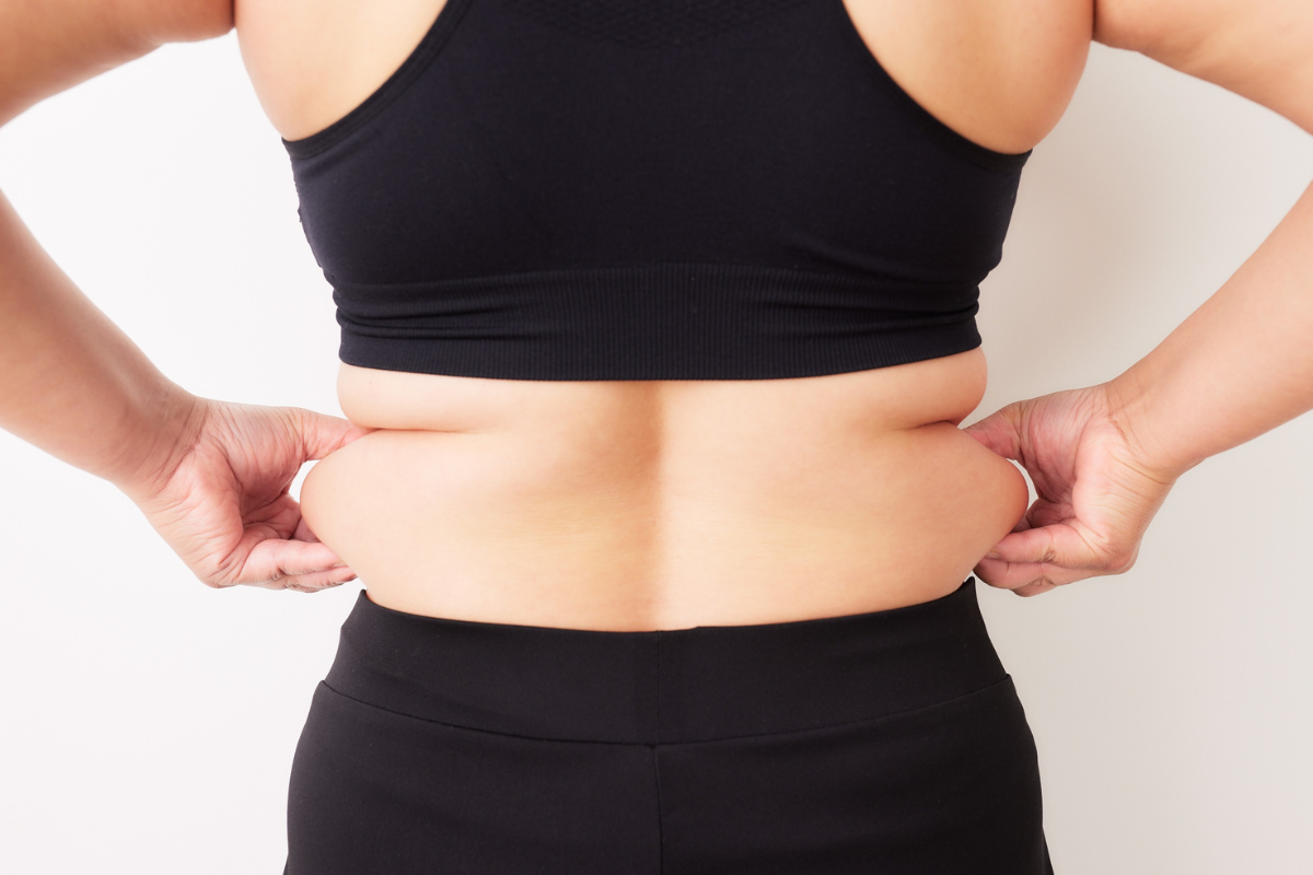 CoolSculpting in boston