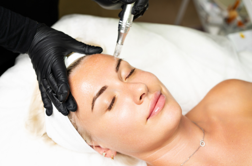 Microneedling, Needham, MA