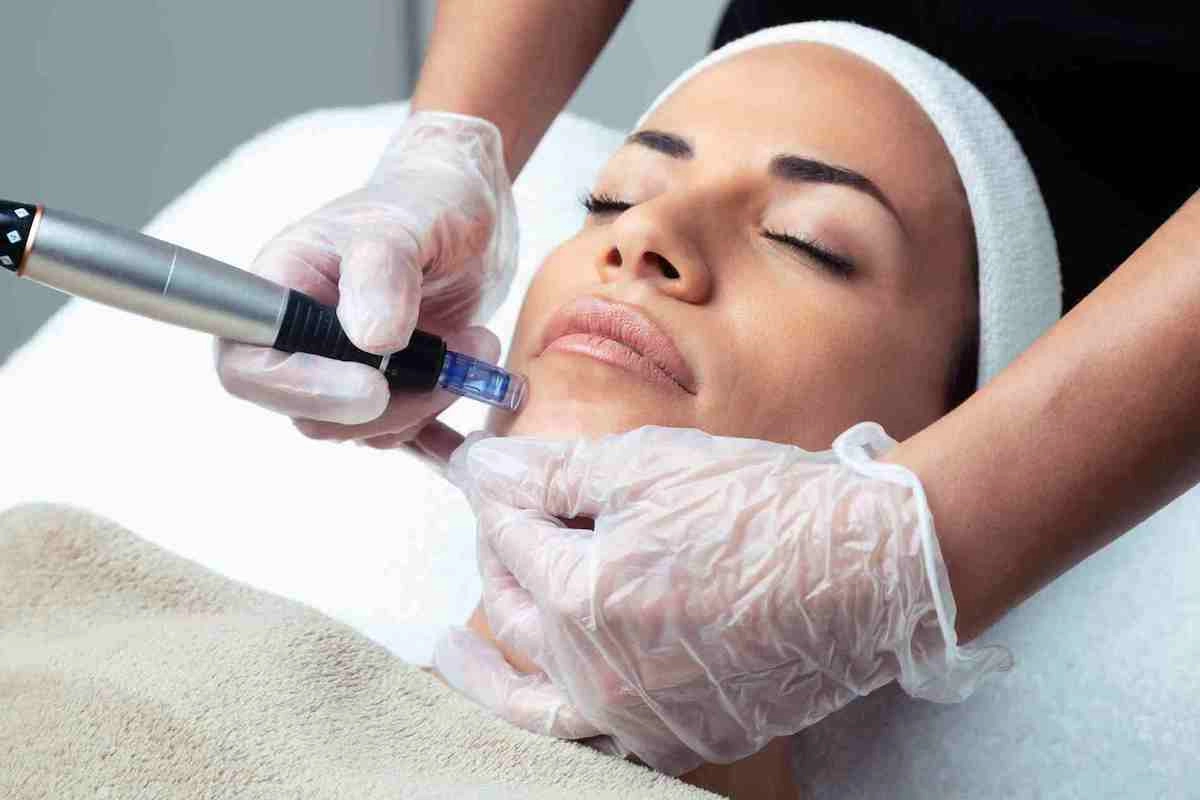 Microneedling in Greater Boston